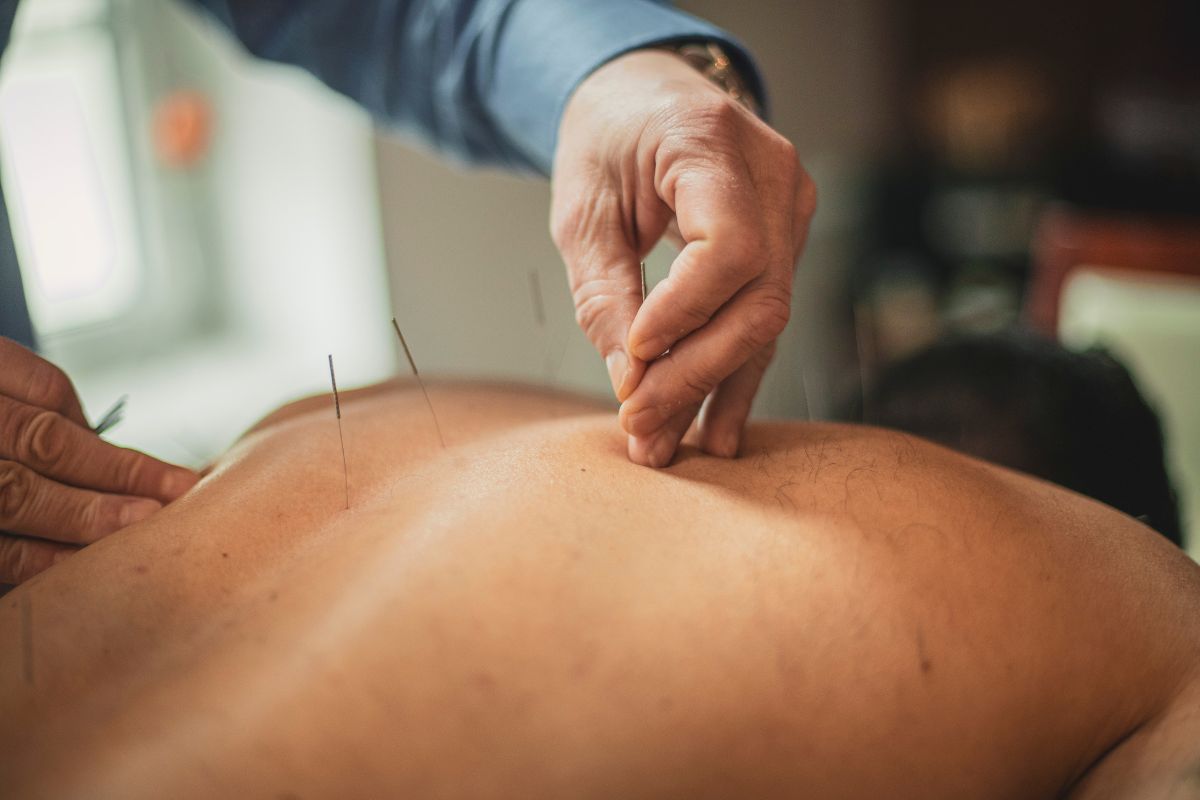 Acupuncture Products